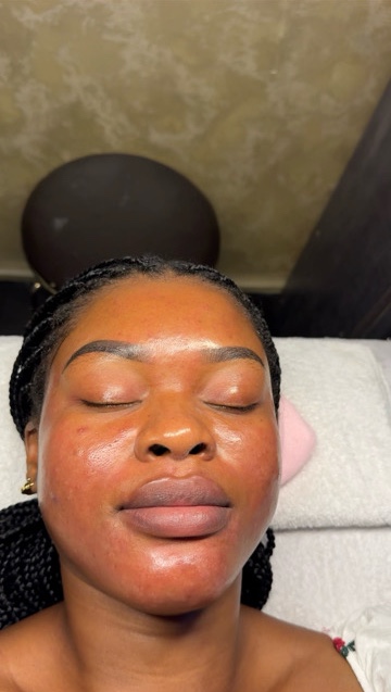 Targetted Facial/ level 2